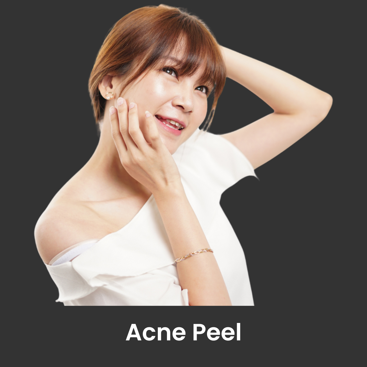 Acne Peel
