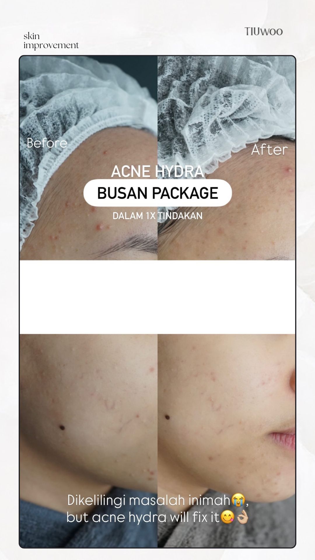 Busan Package Before After