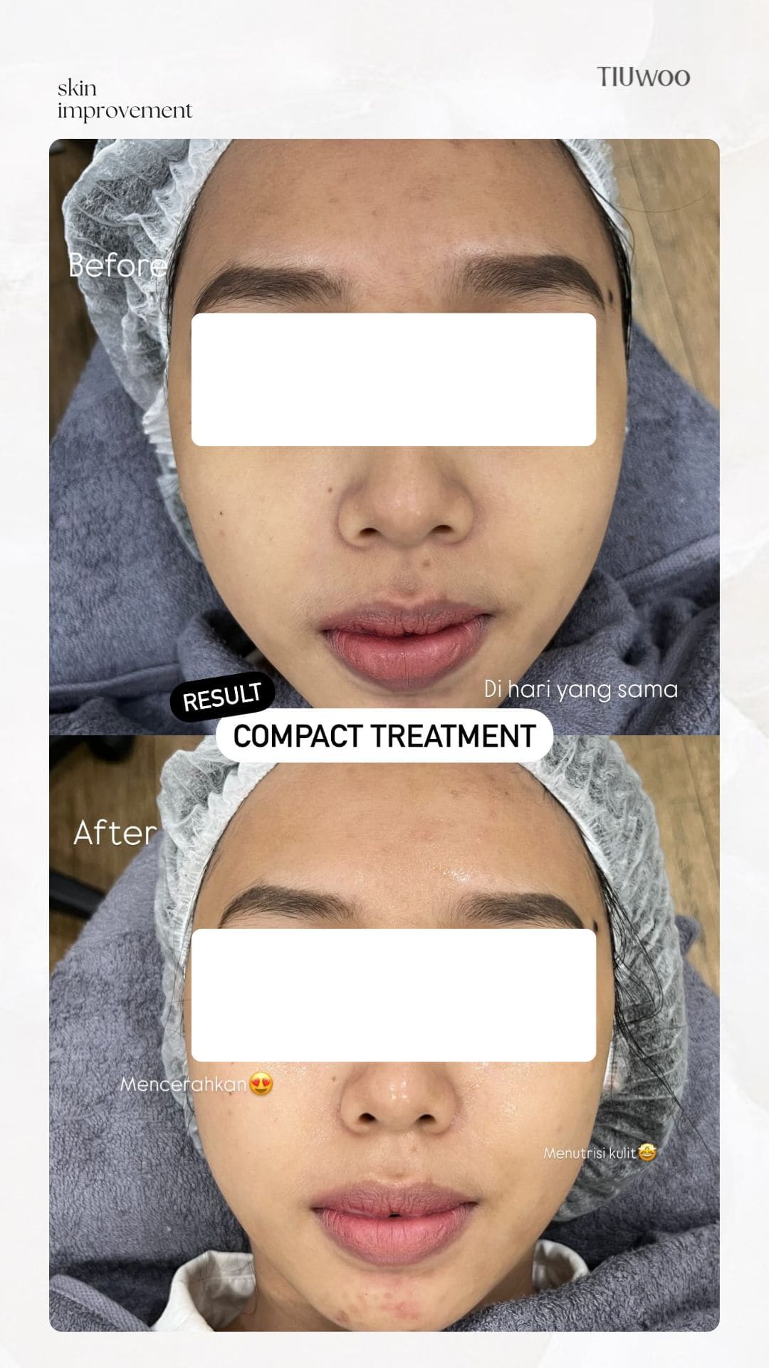 Compact Treatment Before After