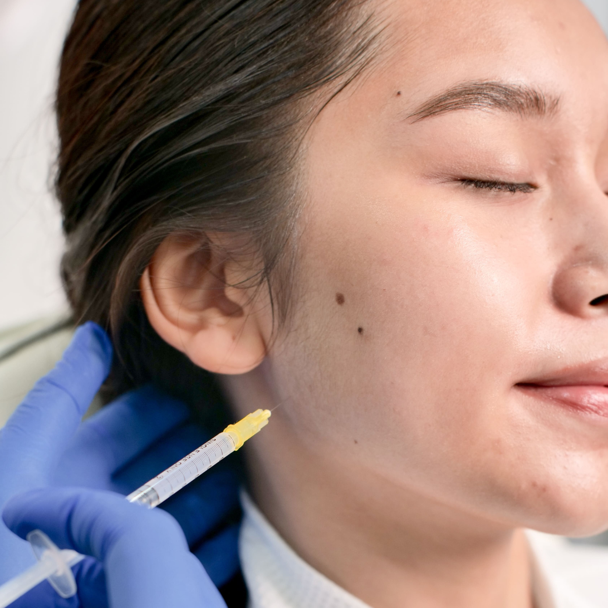Koretox Lower Treatment Information