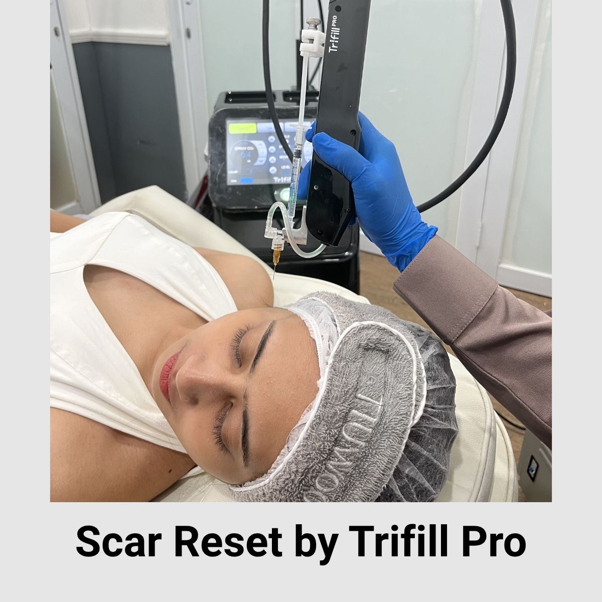 Scar Reset Trifill Pro Cover