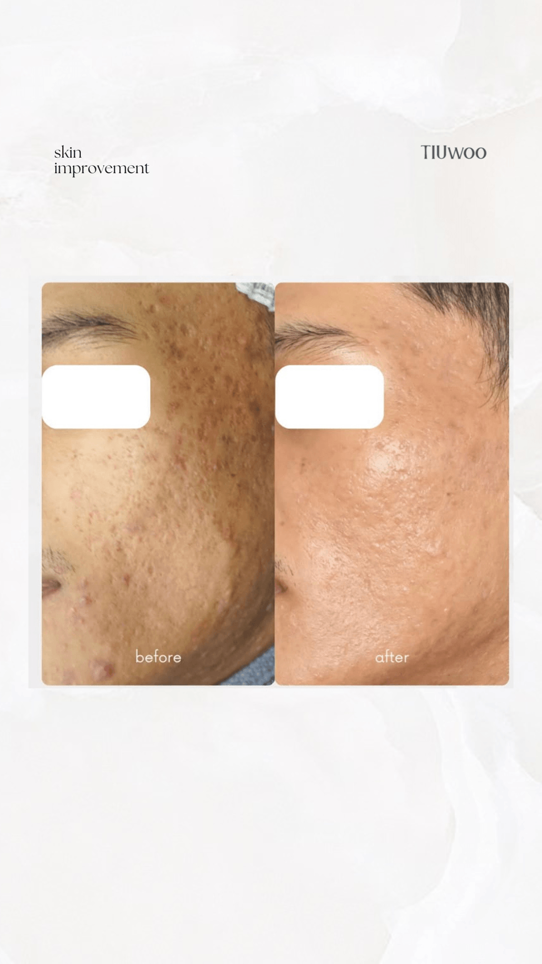 Subsisi Before After