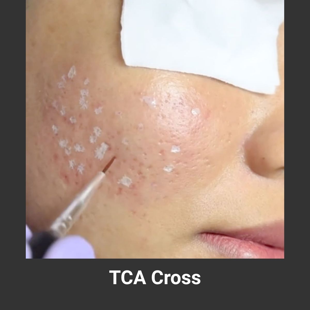 TCA Cross Cover